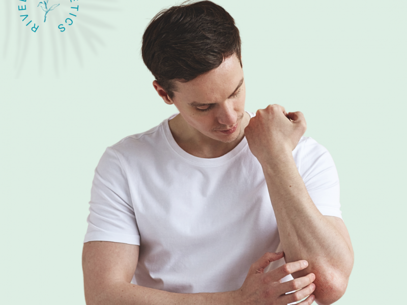 "Leven met Psoriasis: Hoe je met Rivella de schilfertjes en jeuk de baas kunt blijven"